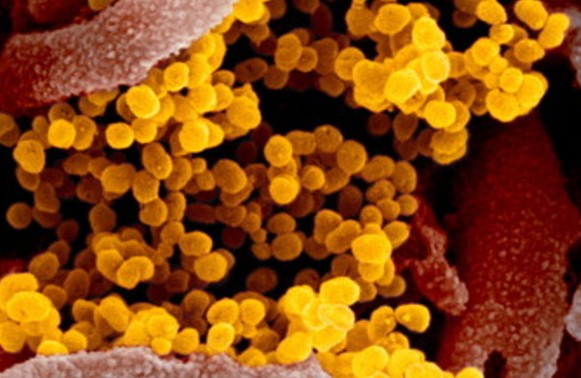 Avviso Importante sul "Coronavirus" non utilizzare il fai da te